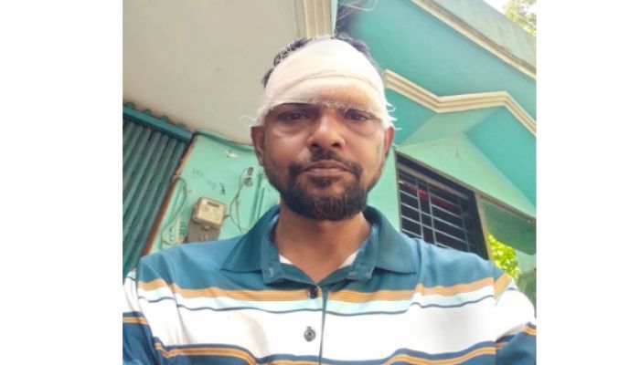 নোয়াখালীতে সড়ক দুর্ঘটনায় সংবাদ সারাবেলার প্রতিনিধি সহ আহত ২