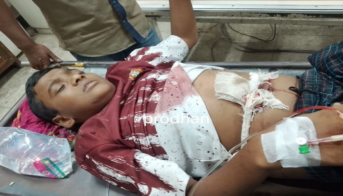 নারায়ণগঞ্জের ফতুল্লায় গার্মেন্টসের ঝুট দখলে নিতে যুবদলের দুই গ্রুপে বন্ধুক যুদ্ধ, গুলিবিদ্ধসহ আহত-১০