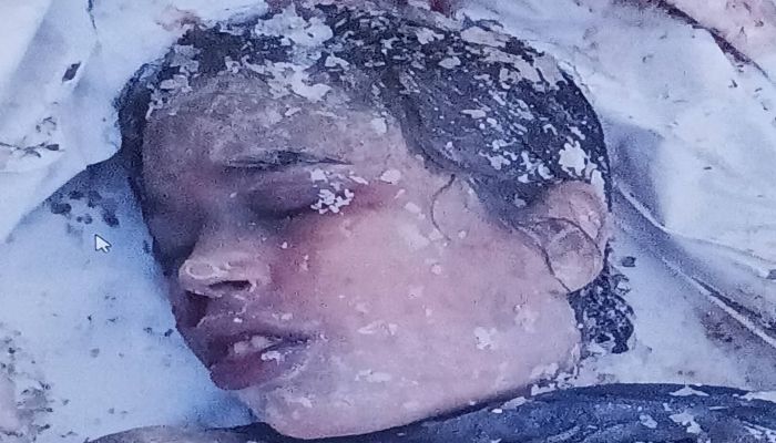 মৌলভীবাজারে রুদ্ধশ্বাস চেষ্ঠায় একমাসেও পরিচয় মেলেনি অজ্ঞাত তরুণীর মৃতদেহের, পুলিশ বলছে সম্ভব    