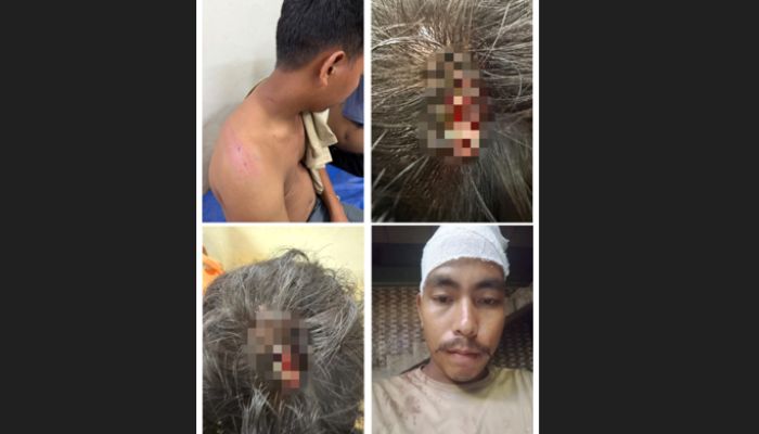 লামায় ‘রয়েল হিল’ রিসোর্ট দখলের চেষ্টা, হামলা ও চাঁদাবাজির অভিযোগে মামলা